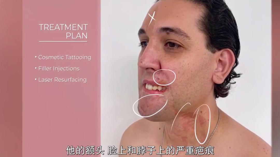 整容能弄成明星的样子吗,整容真的能整漂亮吗