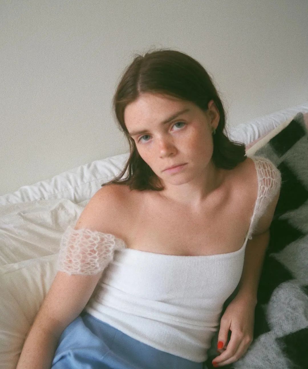 为什么要精灵耳整形,精灵耳招风耳整形