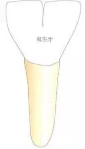 牙齿长成包谷牙怎么办,牙齿长成了双排牙如何矫正