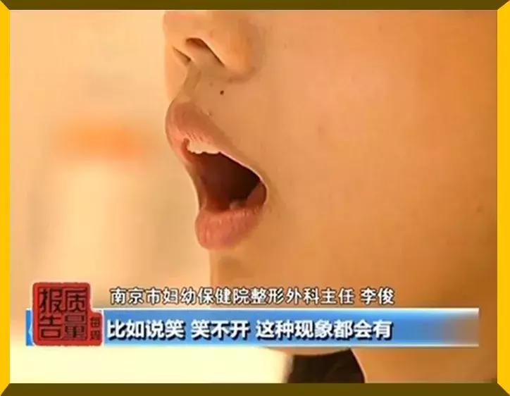 60多岁花450万整容,21岁女子花20万整容