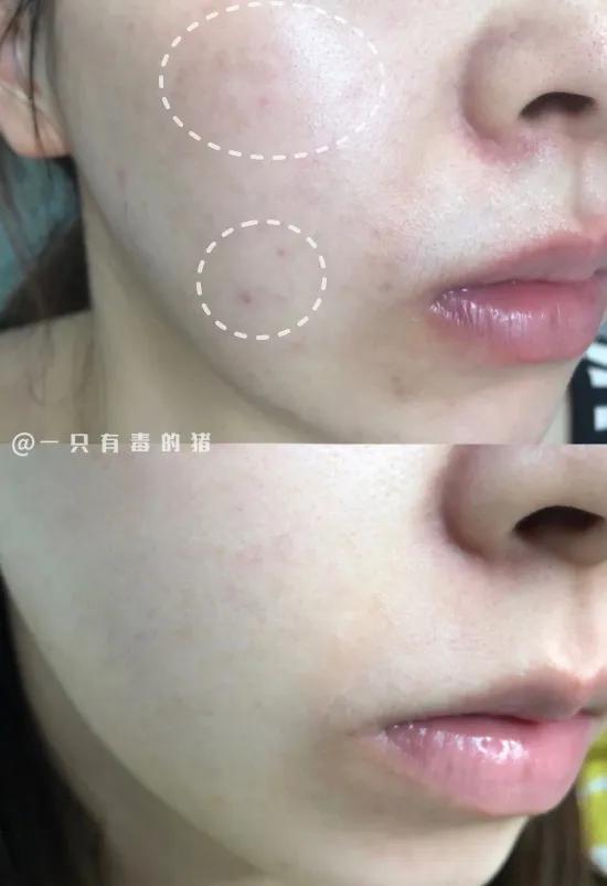 几十块美白精华100ml,几十块的变白护肤品