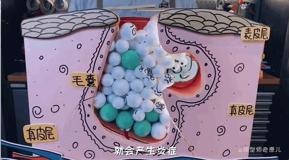 模型师老原儿手被烫伤,模型师老原儿被烫伤