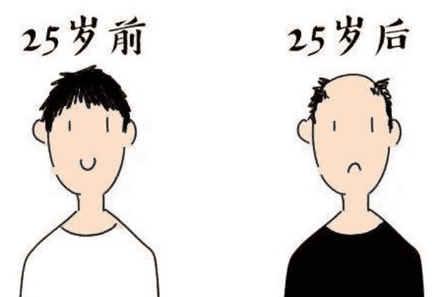 男人都脱发吗,脱发多久内用生姜可以有效生发