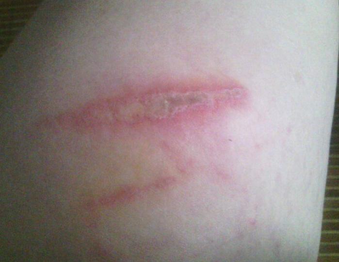 哪些小昆虫对身体有害,生活中常见昆虫存在的危险的视频