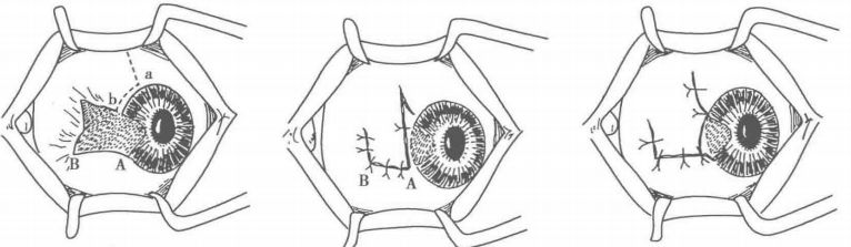 眼睛长出翅膀,眼睛长翅膀