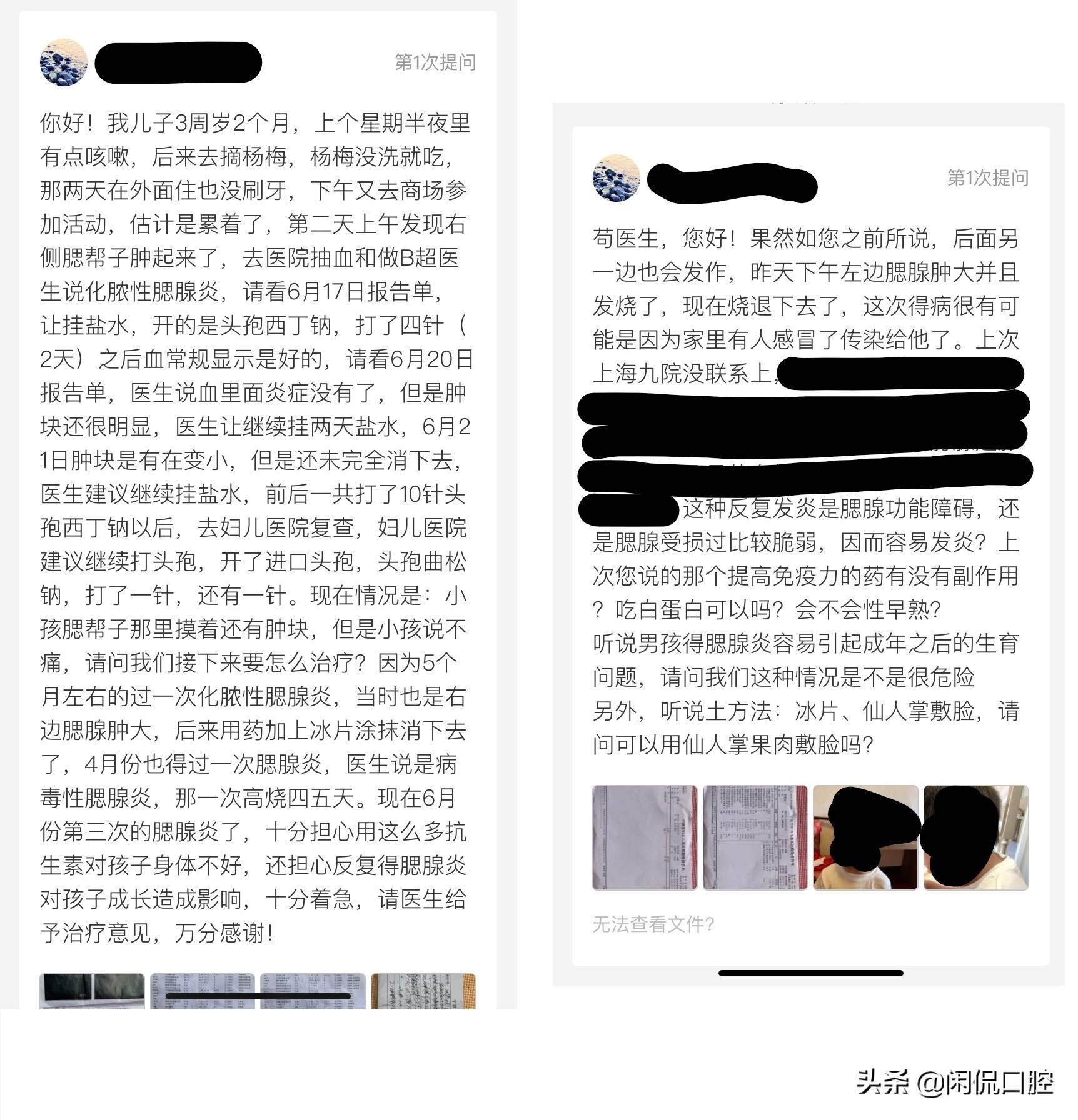 腮腺炎几种类型,腮腺炎的症状用什么药