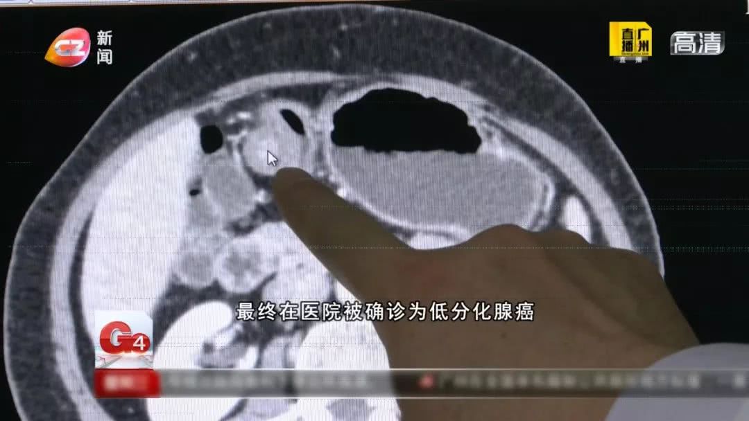 胃疼忍着会伤胃吗,胃疼强忍着