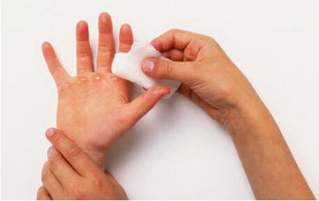 宝宝受伤正确处理方法get,小孩意外受伤注意事项