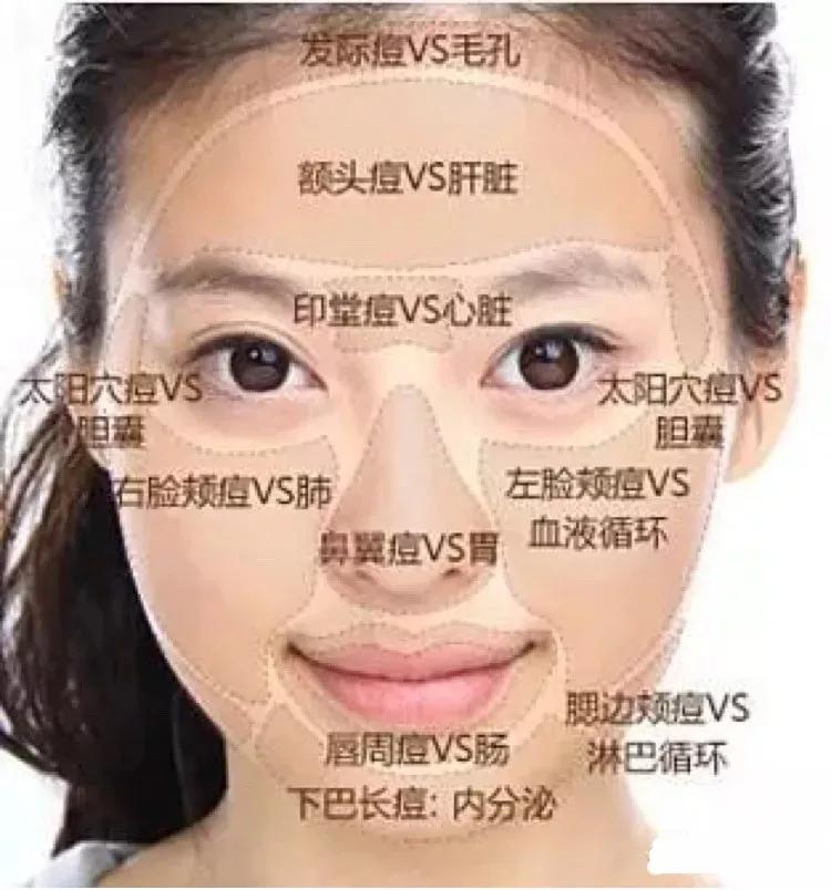 40多岁的女人脸上长痘是什么原因,脸上反复长痘体内排毒的最好方法