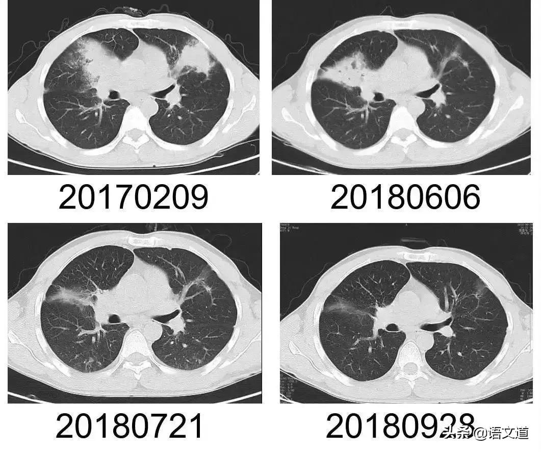 他摸了出土*物文**,然后住院八次