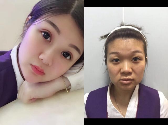 胶原蛋白该怎么补,脸上胶原蛋白流失严重怎么补最好