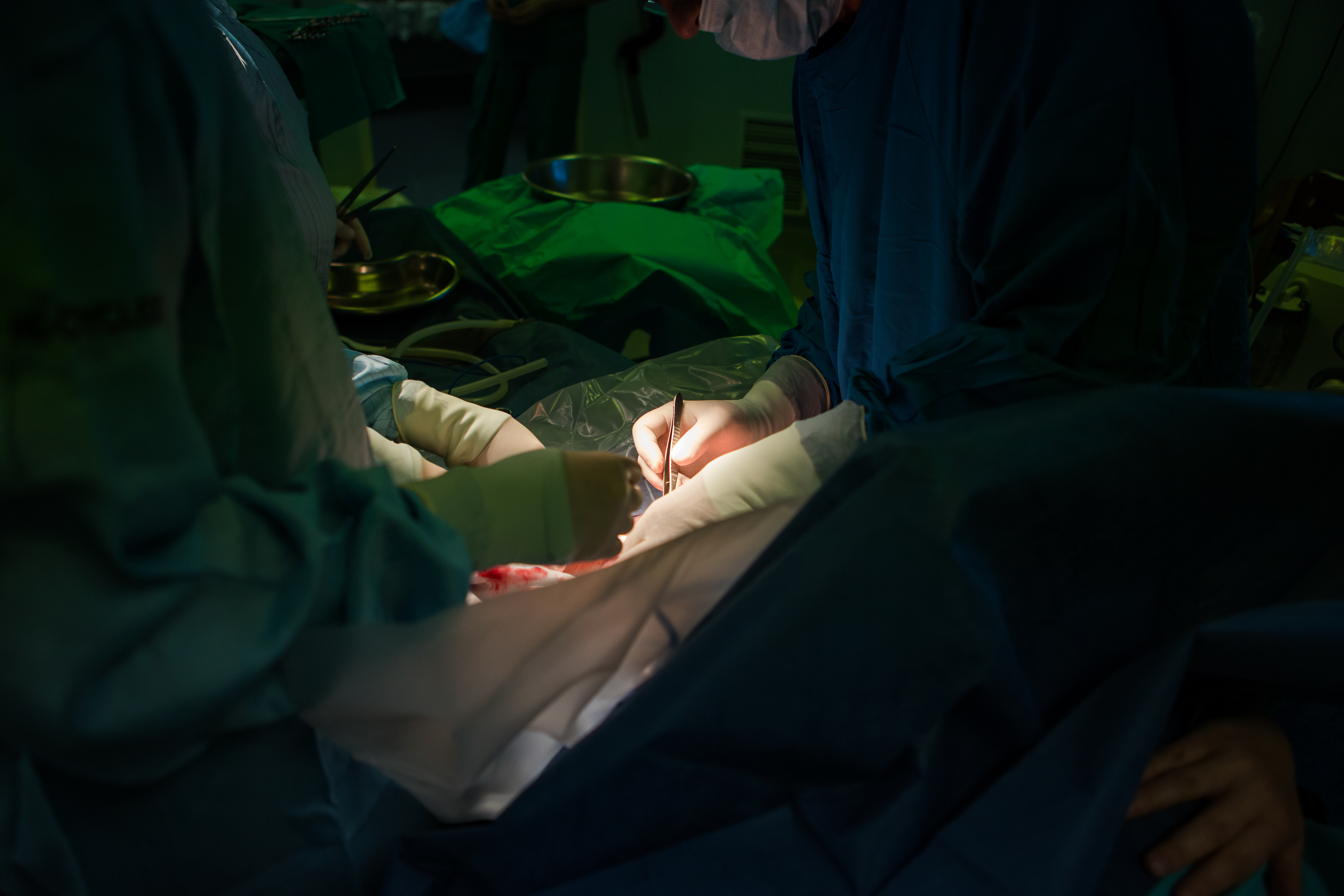 孩子11岁学不会骑自行车，走路易摔跤，剖宫产造成了感统失调？