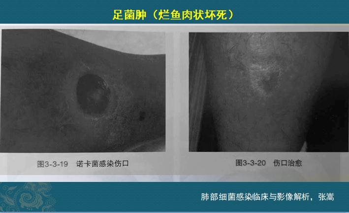 这个细菌提醒你，别买病死的鱼，它是个吃草的细菌，后来学会吃鱼