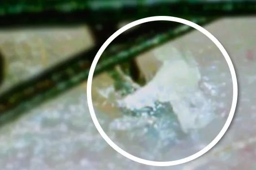 叹头部SPA!拒做人间“油”物,解锁防秃养发小妙招