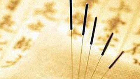 选择针灸,选针灸推拿学的理由