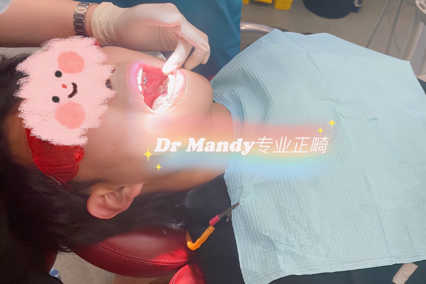 杭州如何选择牙齿矫正,杭州牙齿矫正哪个医生好