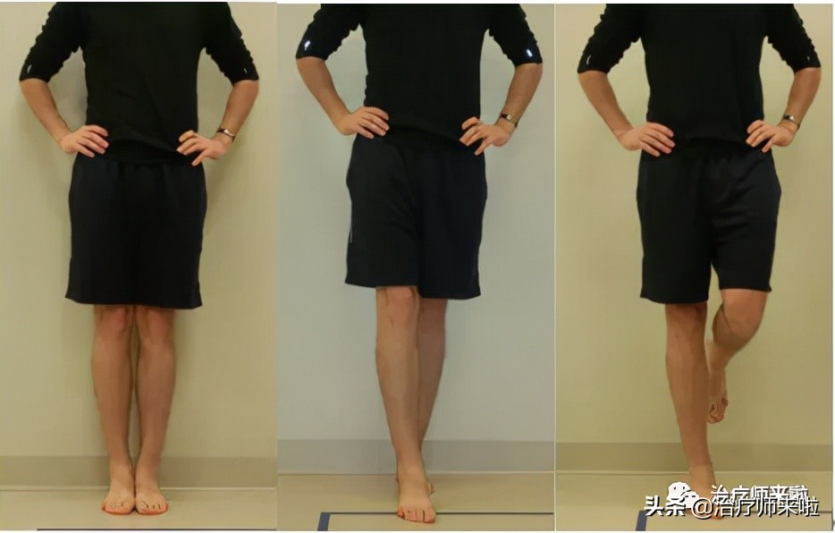 踝关节韧带重建康复北医三院,踝关节韧带重建手术后遗症