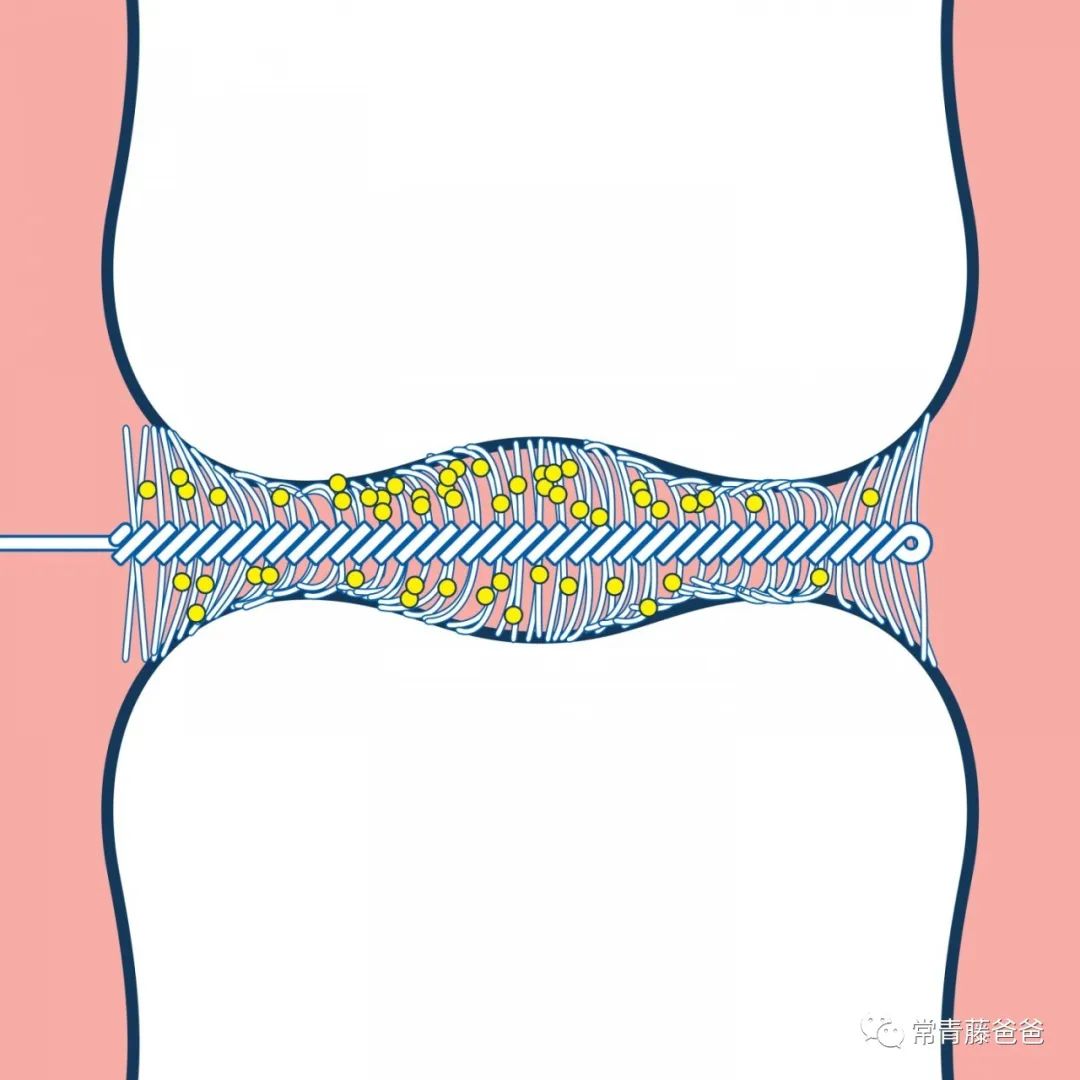 孩子有了龋齿刷牙还有用吗,用牙线清理牙缝很臭是蛀牙吗
