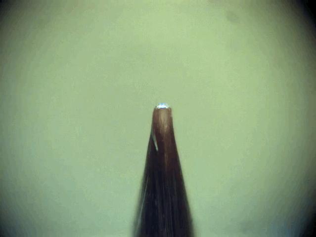 孩子膀胱容量130,儿童最大膀胱容量197正常吗