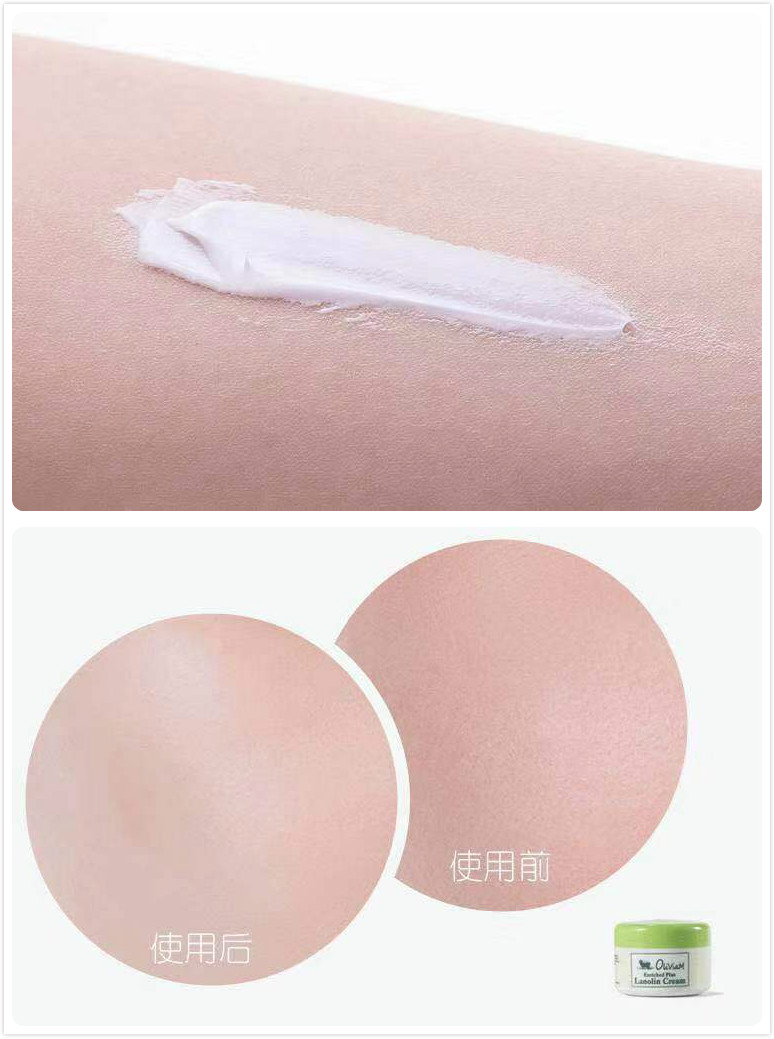 澳洲绵羊油对敏感肌有用吗,澳洲绵羊油保湿霜精华