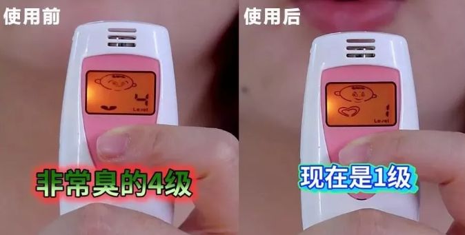 简单三招告别口臭尴尬,口臭的小妙招一招搞定