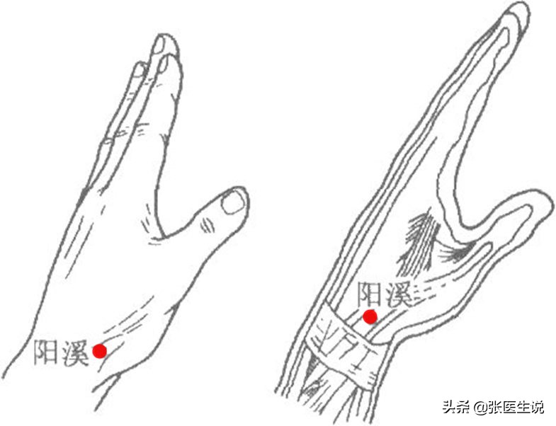 手腕痛并且无力要怎么治,手腕特别难受怎么办快速解决