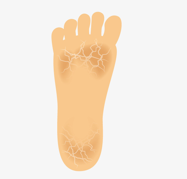 科普为什么会脚臭,科普脚臭是什么原因导致的