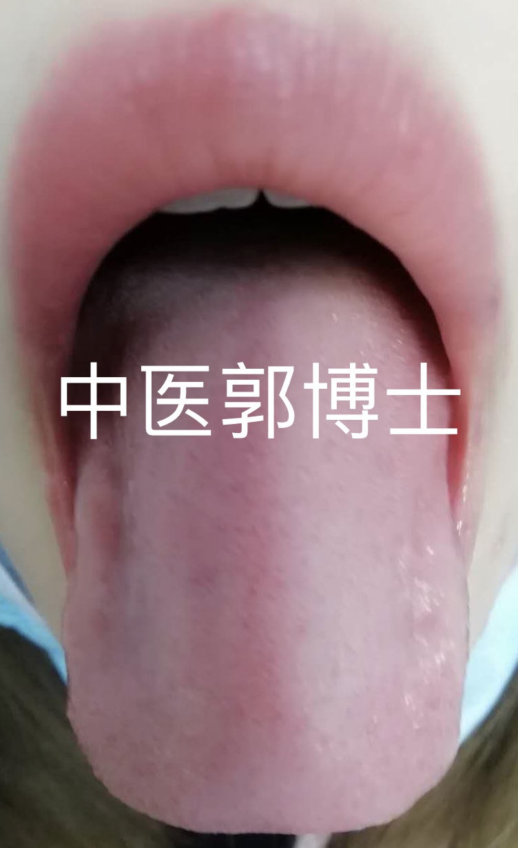 女性便秘大便带血是什么原因,增水行舟法治疗便秘