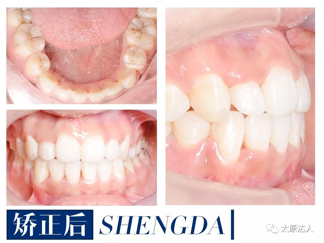 山西“爱马仕”级别齿科医院!get明星同款笑容