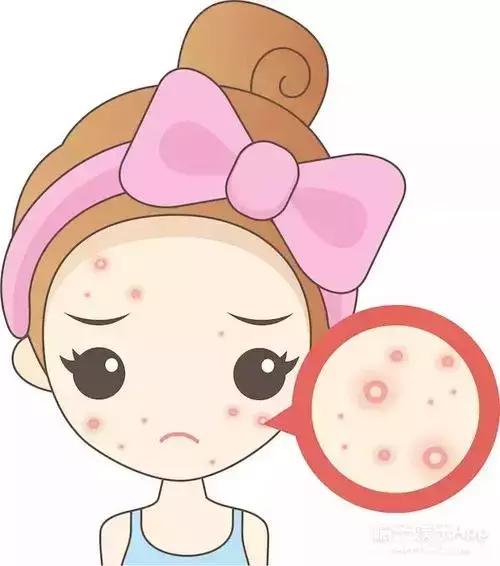 十八岁满脸长青春痘怎么调理,抗痘达人的抗痘秘籍