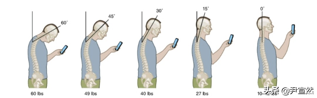 怎么改善头前倾的体态,改善头前倾的动作最有效