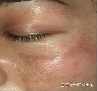 女性在怀孕后身体会发生什么变化,女性受孕后身体会发生哪些变化