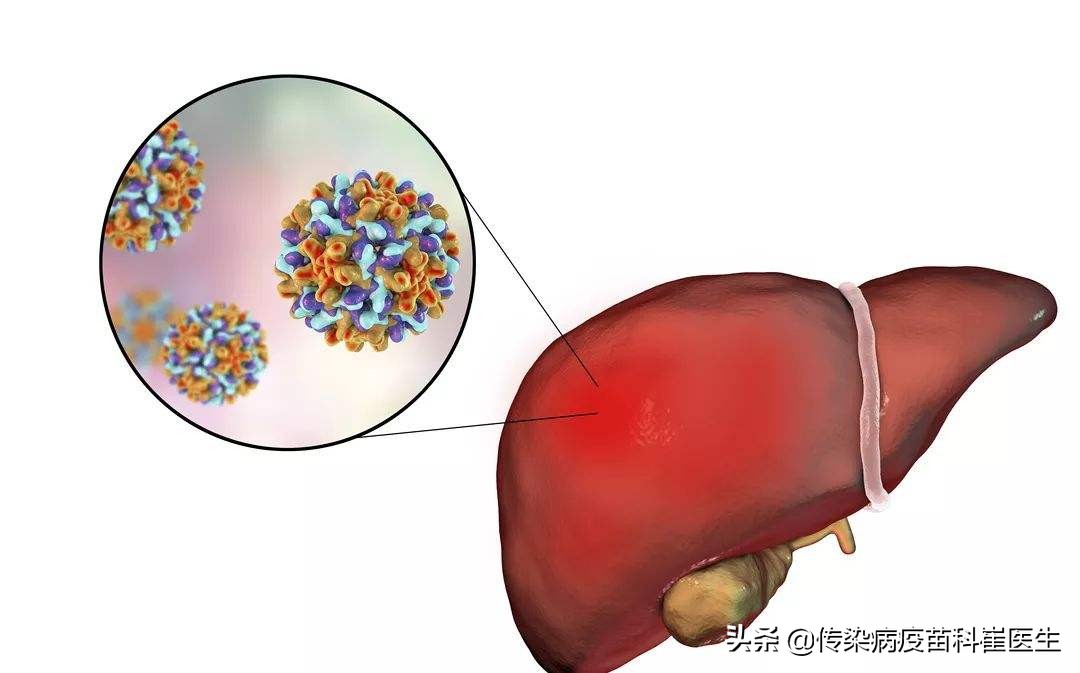 幼儿园体检出来没有乙肝抗体,幼儿园体检没有乙肝抗体必须打吗