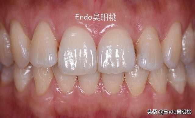 雾里看花墙布,雾里看花找枯枝