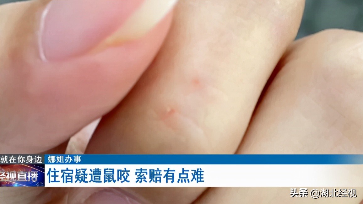 住酒店被小虫咬了一个小洞,住民宿被老鼠咬了