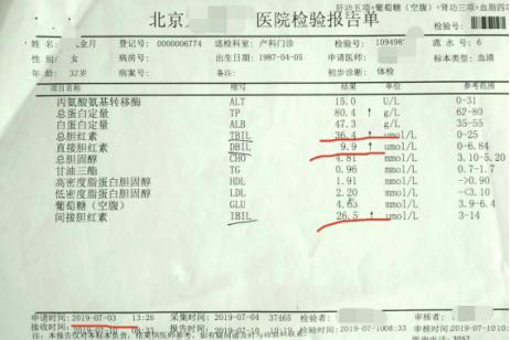 胆红素升高如何改善,成人总胆红素25.2偏高要不要紧