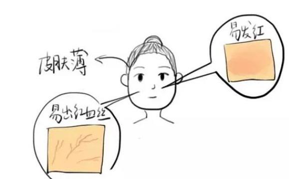 换季皮肤干燥起皮怎么办,一换季皮肤干燥发痒怎么办