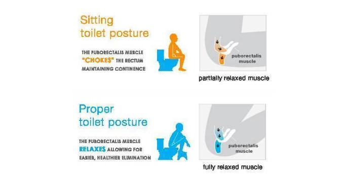 如何选购智能马桶盖板,小户型智能马桶盖选哪个