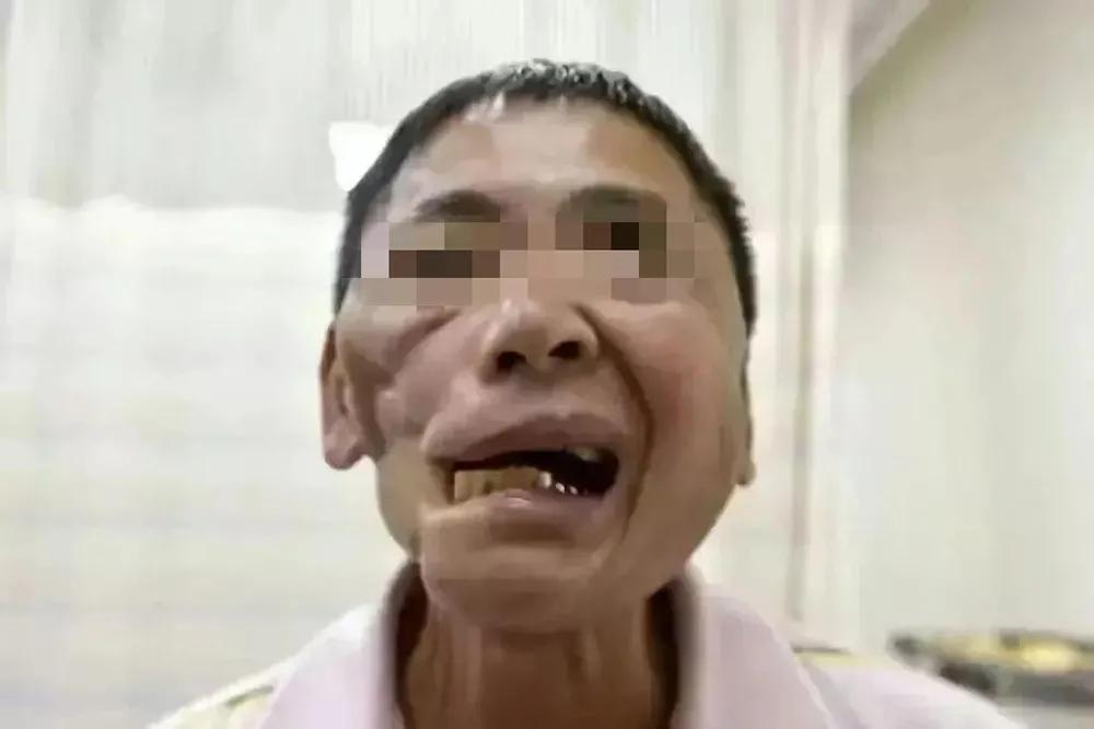 为什么不吃槟榔果,槟榔怎么吃才正确