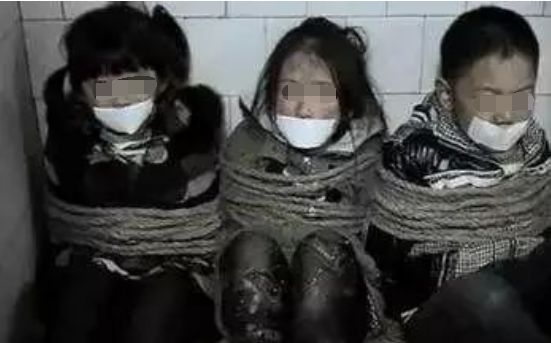 眼球被挖了还能接回去吗,眼球被挖掉了还能恢复么