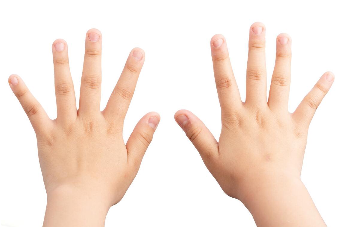 小孩没有得手足口病脱甲怎么回事,5岁小孩突然脱指甲怎么回事