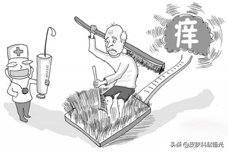 小腹臀部下肢寒冷瘙痒怎么回事,寒冷性荨麻疹如何减少瘙痒