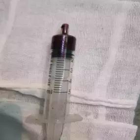 脑干出血五毫升还有救吗,脑干出血5ml危险期