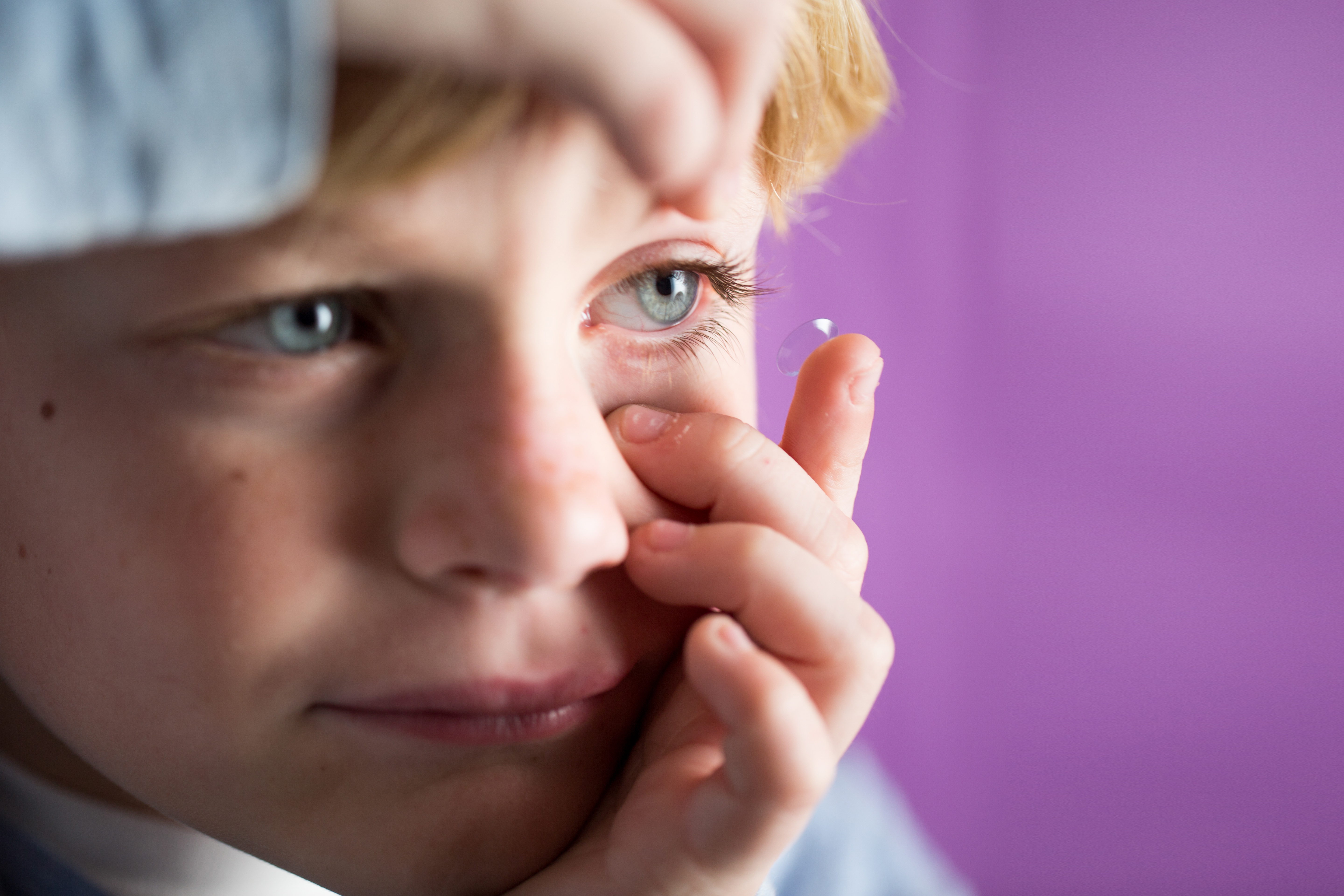 一个近视孩子妈妈的心路历程---角膜塑形镜攻略