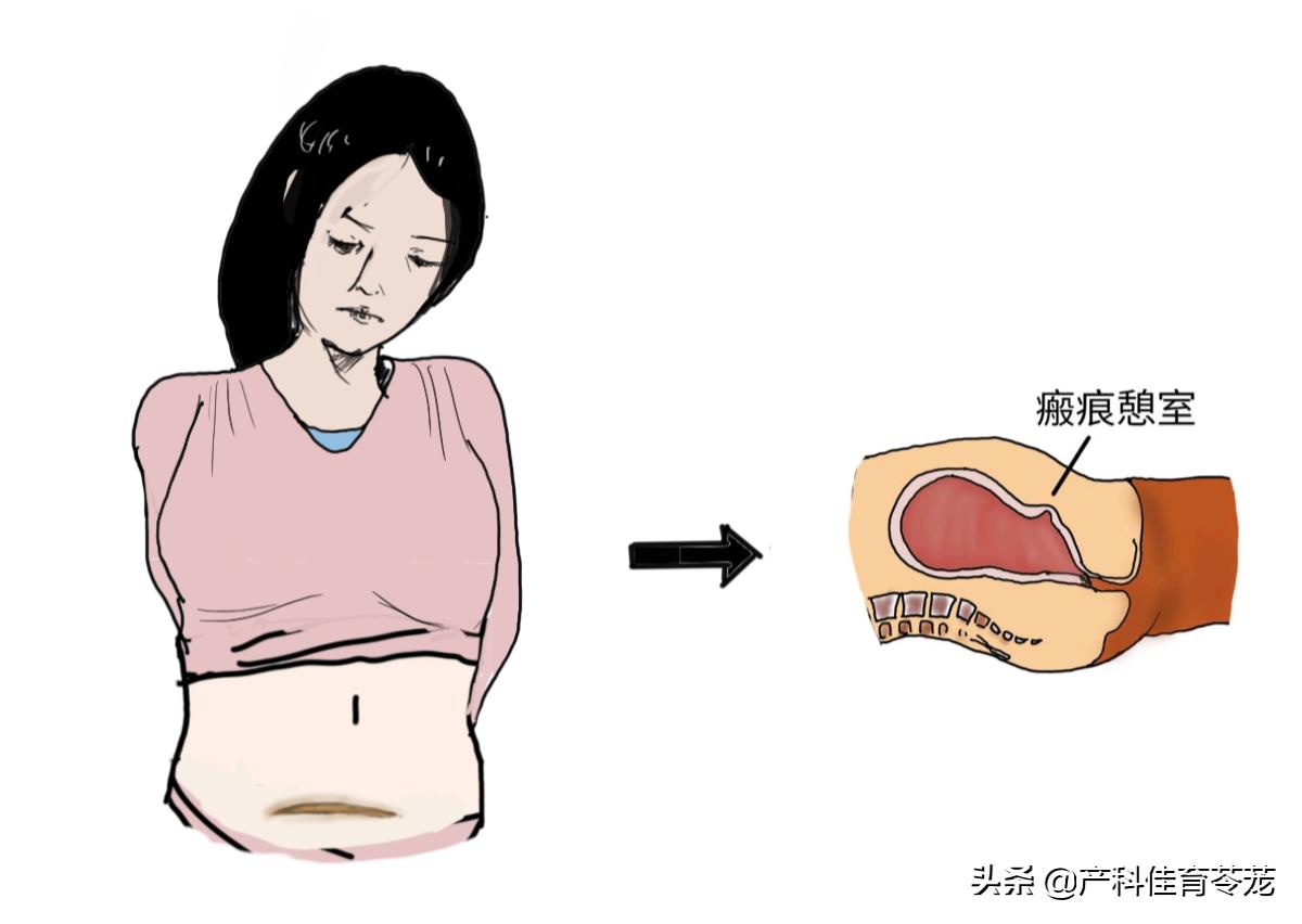 月经老不干净什么原因引起的,年龄50岁月经一直不干净