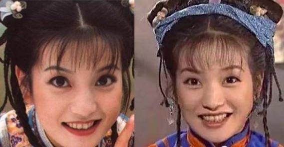 明星为了流量有多拼,赵薇牙齿矫正对比