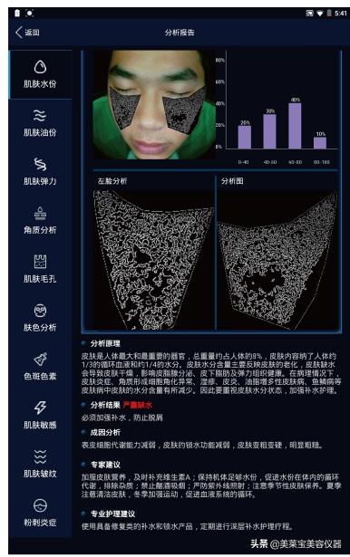 皮肤测试仪器可以测试出哪些,皮肤检测仪分析斑