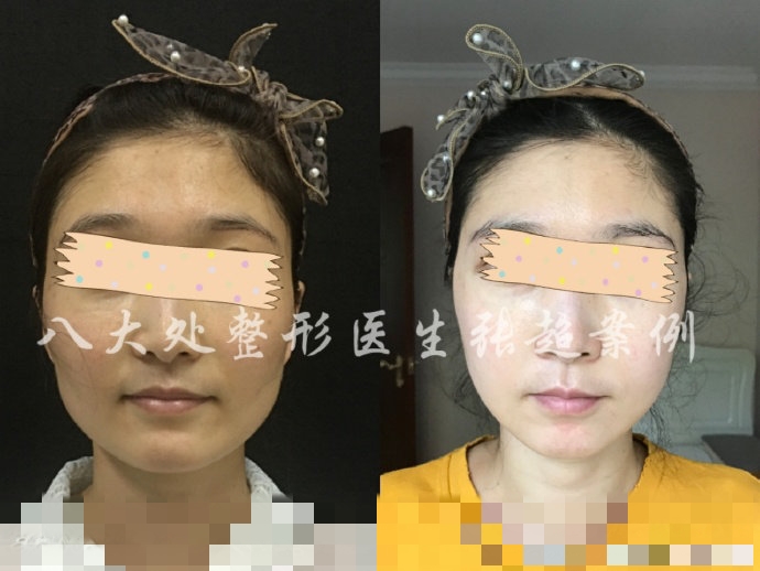 八大处张超抖音,八大处张超合集