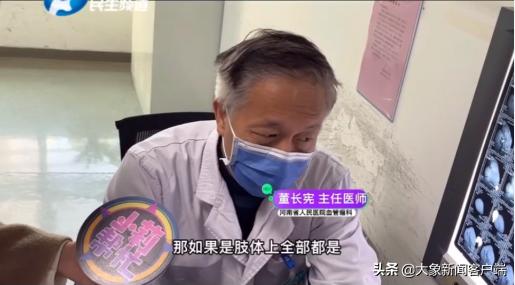 河南12岁“象腿”男孩，可能要面临截肢