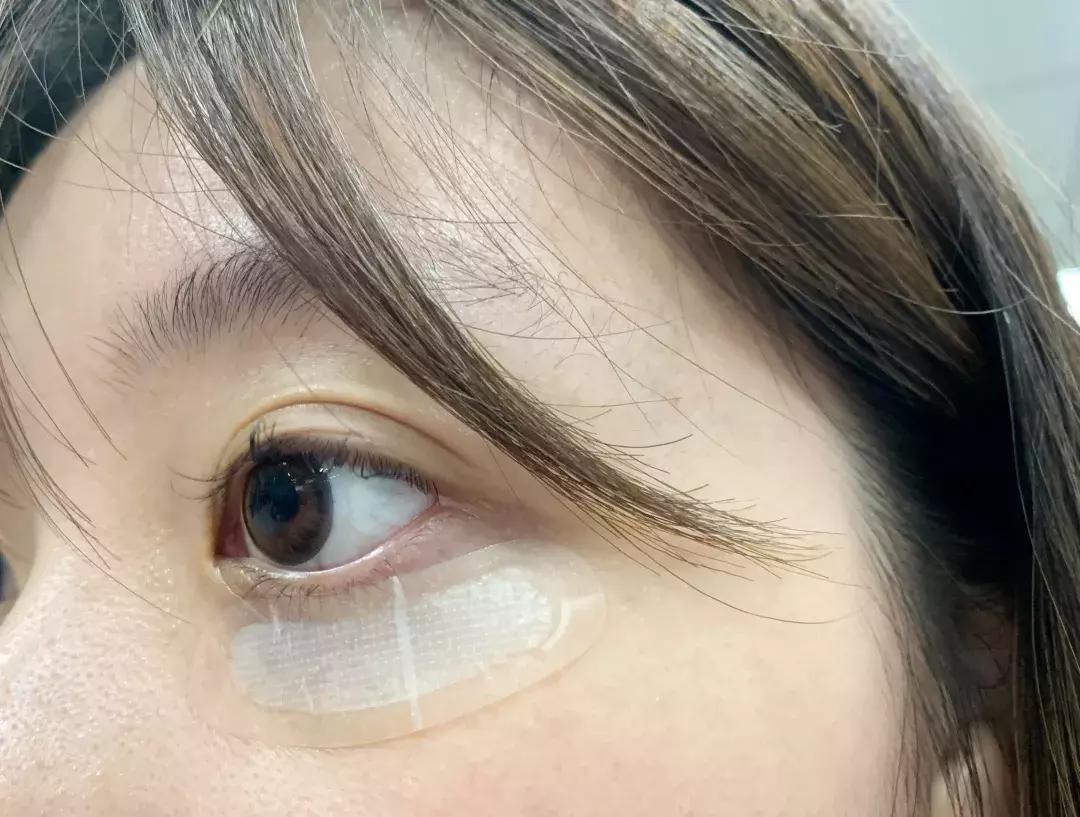 有了前法国第一夫人的百元“黑科技”眼霜，我把3000块眼霜扔了！